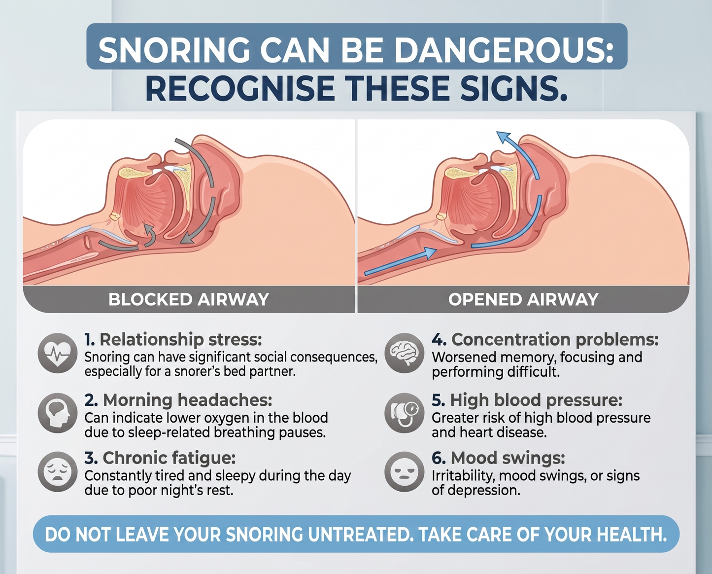 Nightrest™ Anti-Snore Mouthpiece – Sleep Peacefully Again